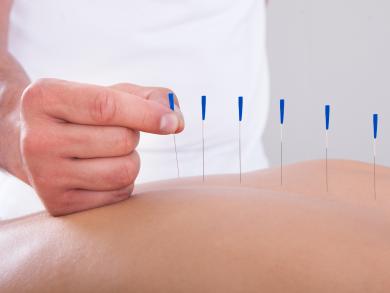 Parkinson's disease and acupuncture