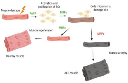 The importance of studying different muscle groups in ALS