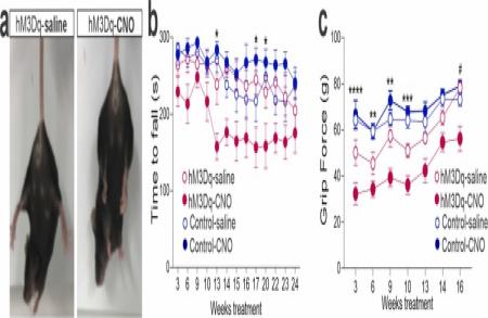 Une autre étude sur les effets de l'excito-toxicité sur les neurones moteurs supérieurs