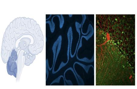 Energy deficiencies in DNA repair may cause certain forms of ALS.